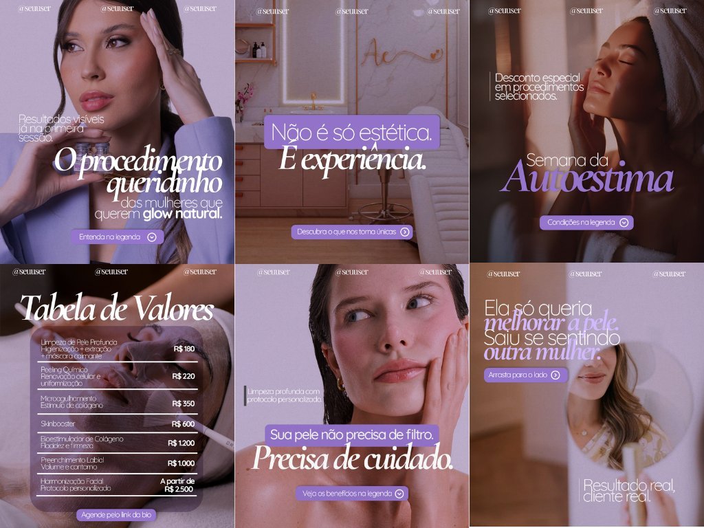 Design de posts para clínica de estética — paleta lilás e feminina com foco em procedimentos